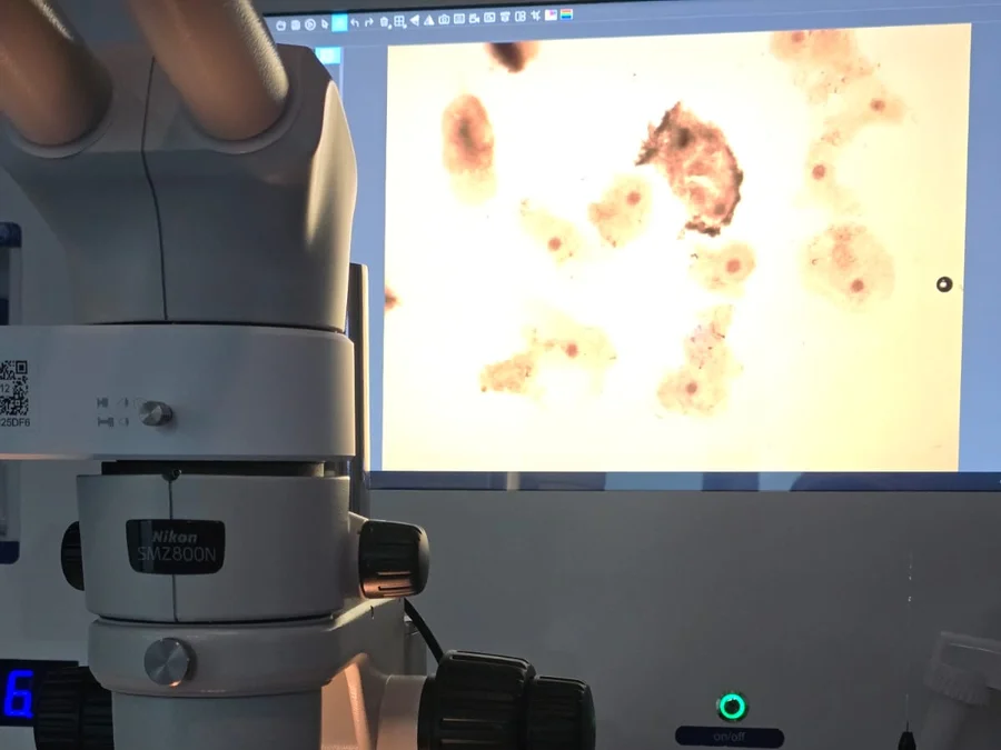 Fecundación in Vitro